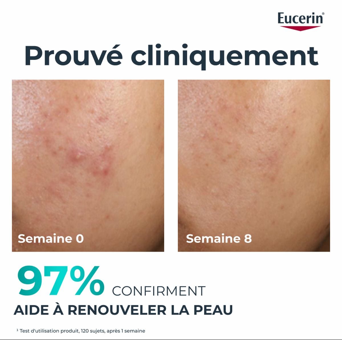 Soin de Nuit Régénérant la Peau Clinical