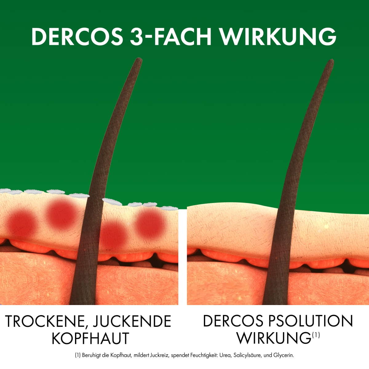 Beruhigendes Pflegeshampoo gegen trockene juckende Kopfhaut
