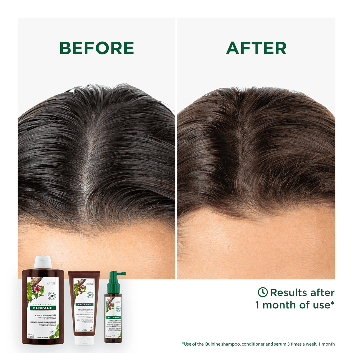 Conditioner for Hair Loss