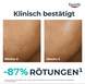 Clinical Therapiebegleitende Feuchtigkeitspflege