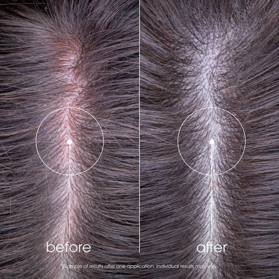 Soothing Organic Conditioner for Sensitive Scalp