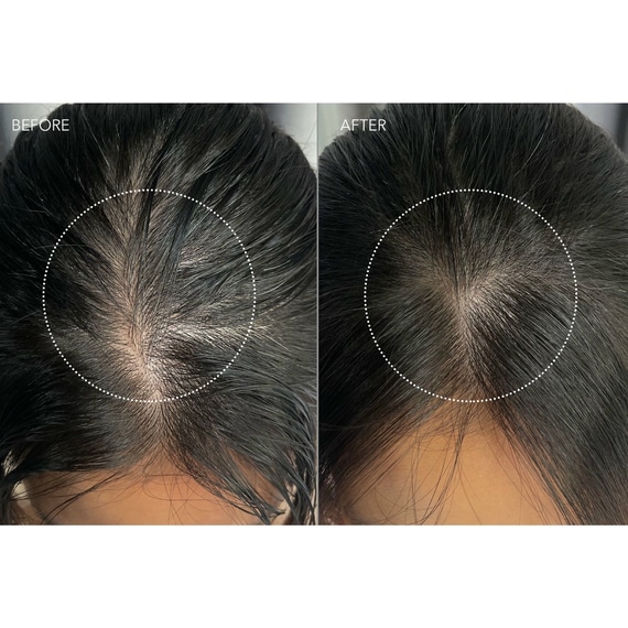 LUNA Dual-Peptide Scalp Serum