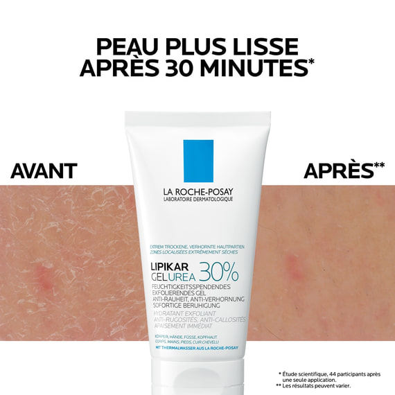 Gel exfoliant hydratant Urea 30%