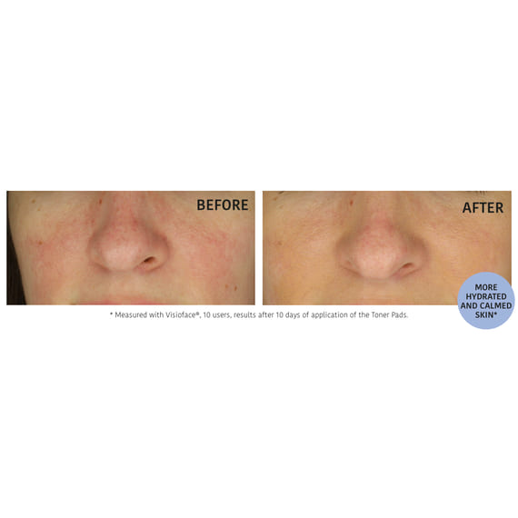 Pre-soaked Pads Hydrating Toner - Glycolic Acids & Pineapple Enzymes