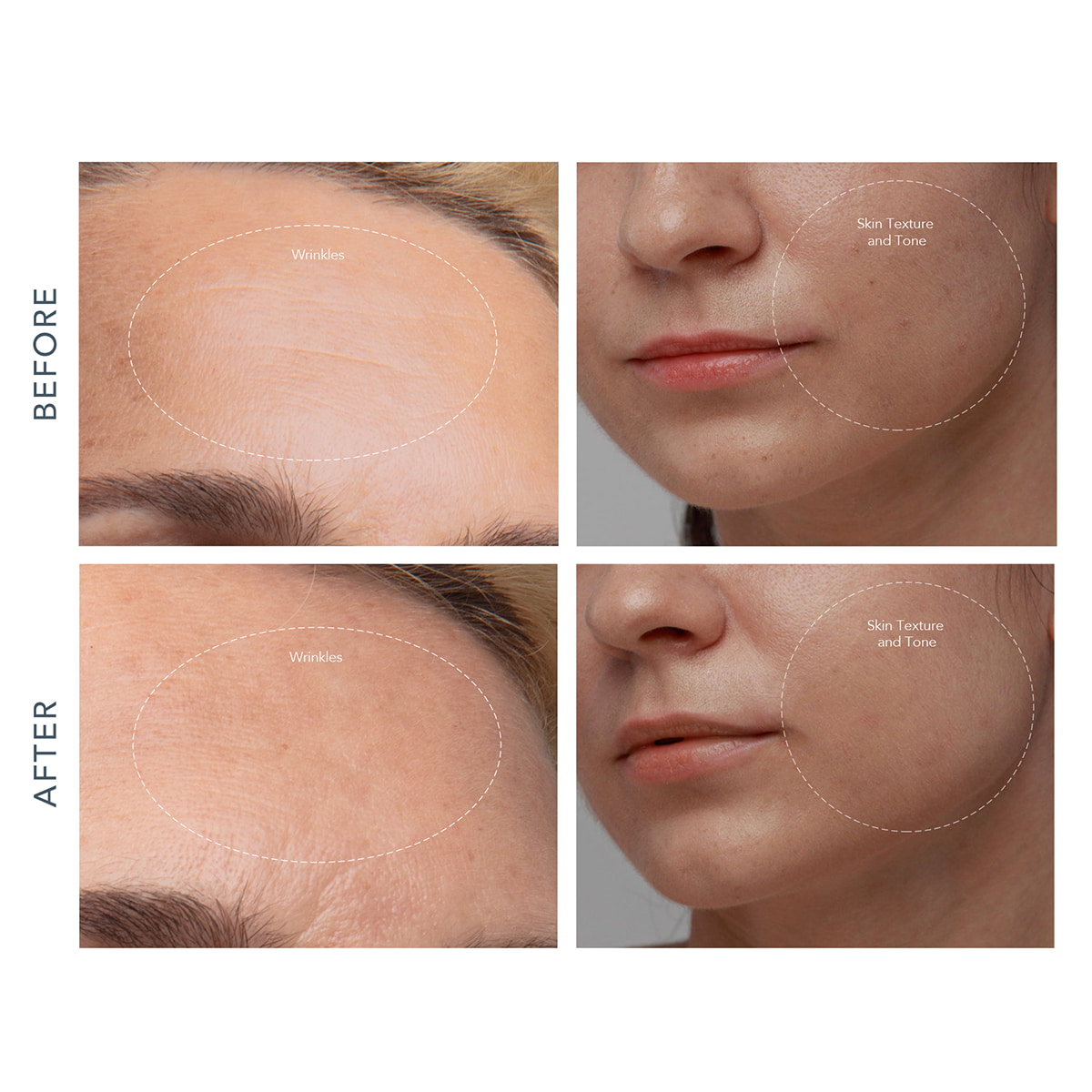 KIWI Derma