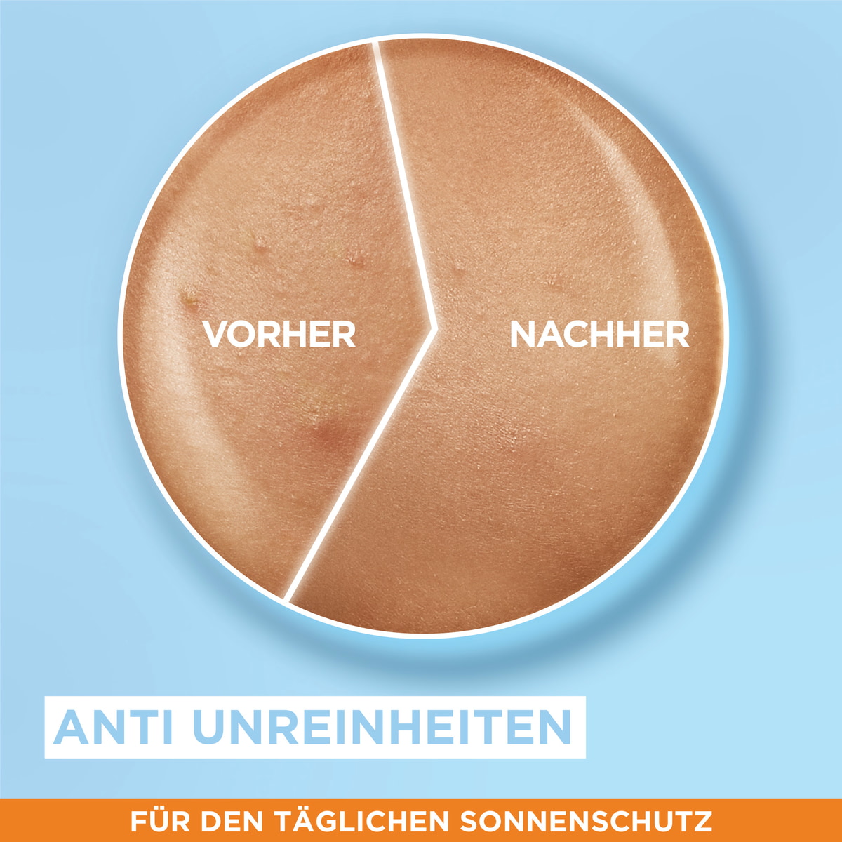 Sensitive expert+ Super UV Protection Fluid with Hyaluronic Acid SPF 50