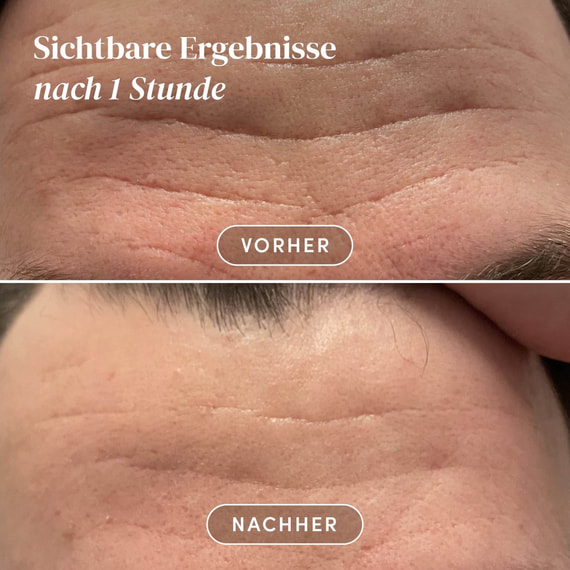 Gesicht Patches mit Aloe Vera