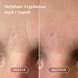 Gesicht Patches mit Hyaluron - Mini