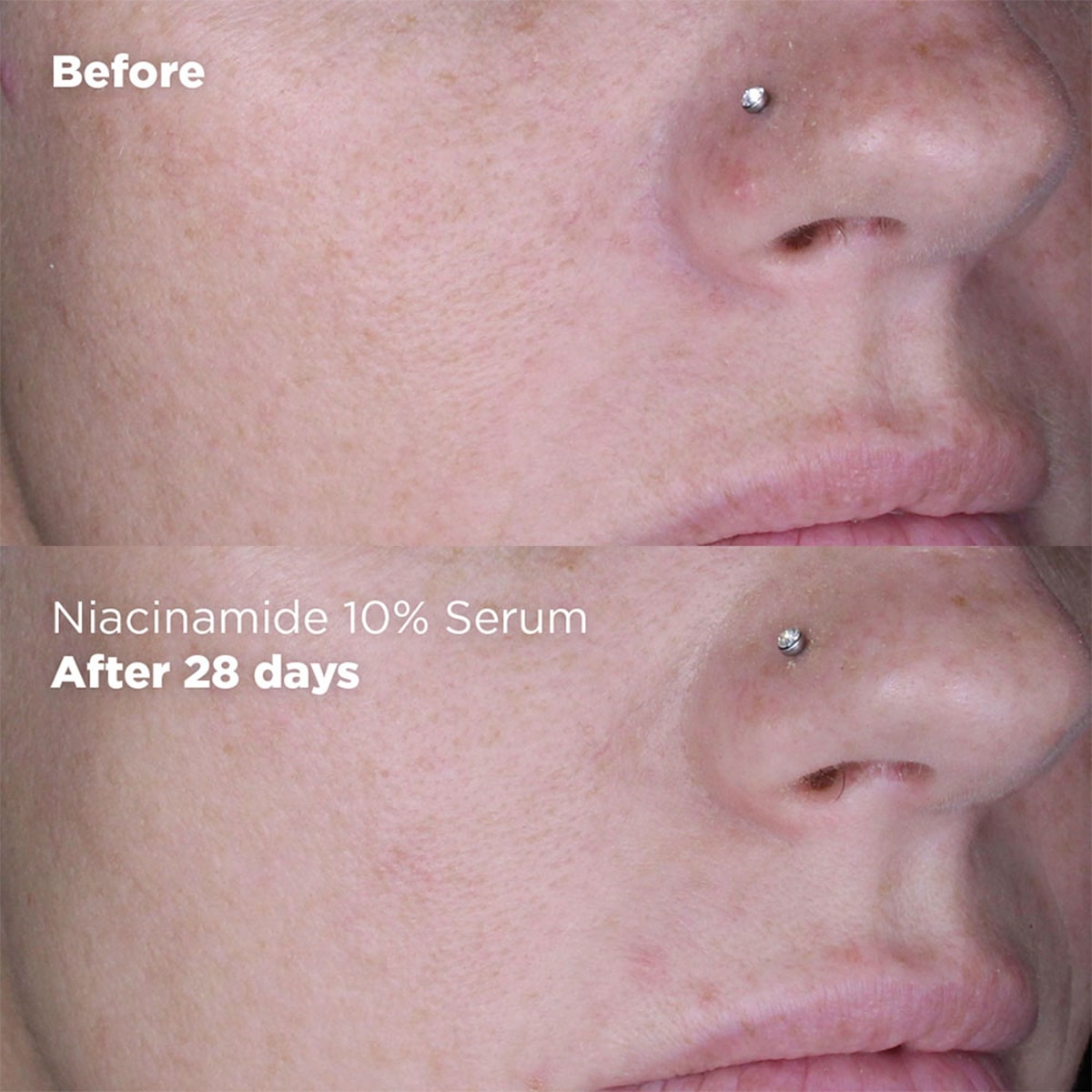 Sérum Niacinamide 10% + Zinc 1%