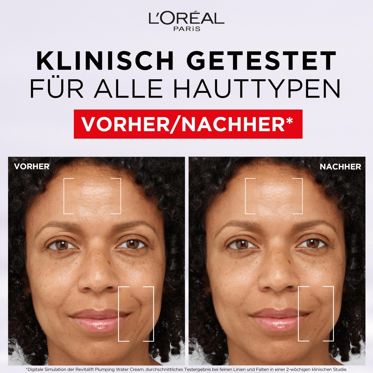 Gel-crème filler