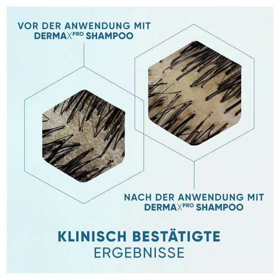 Anti-Schuppen Shampoo Beruhigende Pflege
