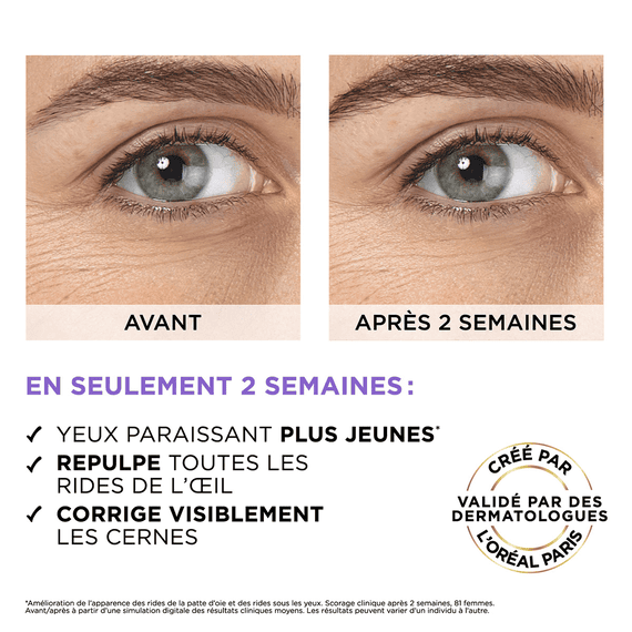 Filler Sérum Yeux