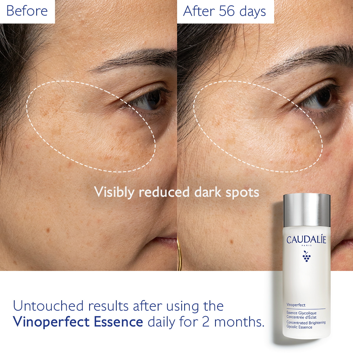 Concentrated Brightening Glycolic Essence