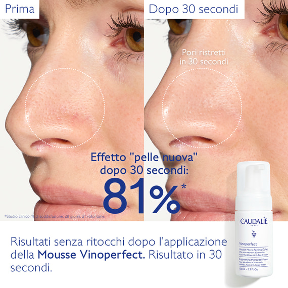 Mousse Micro-Peeling