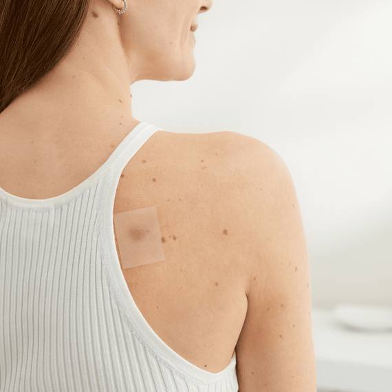 Scar Reduction