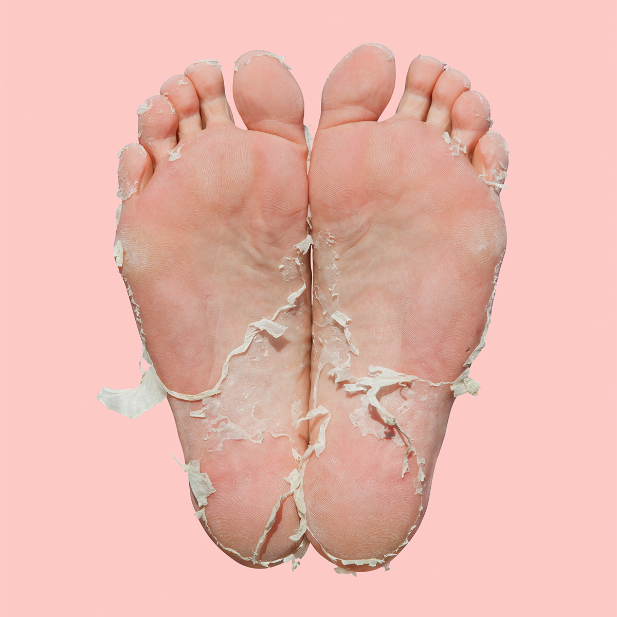 Masque Pieds Pedi Peel Max