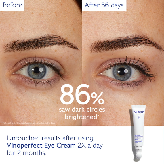 Dark Circle Brightening Eye Cream