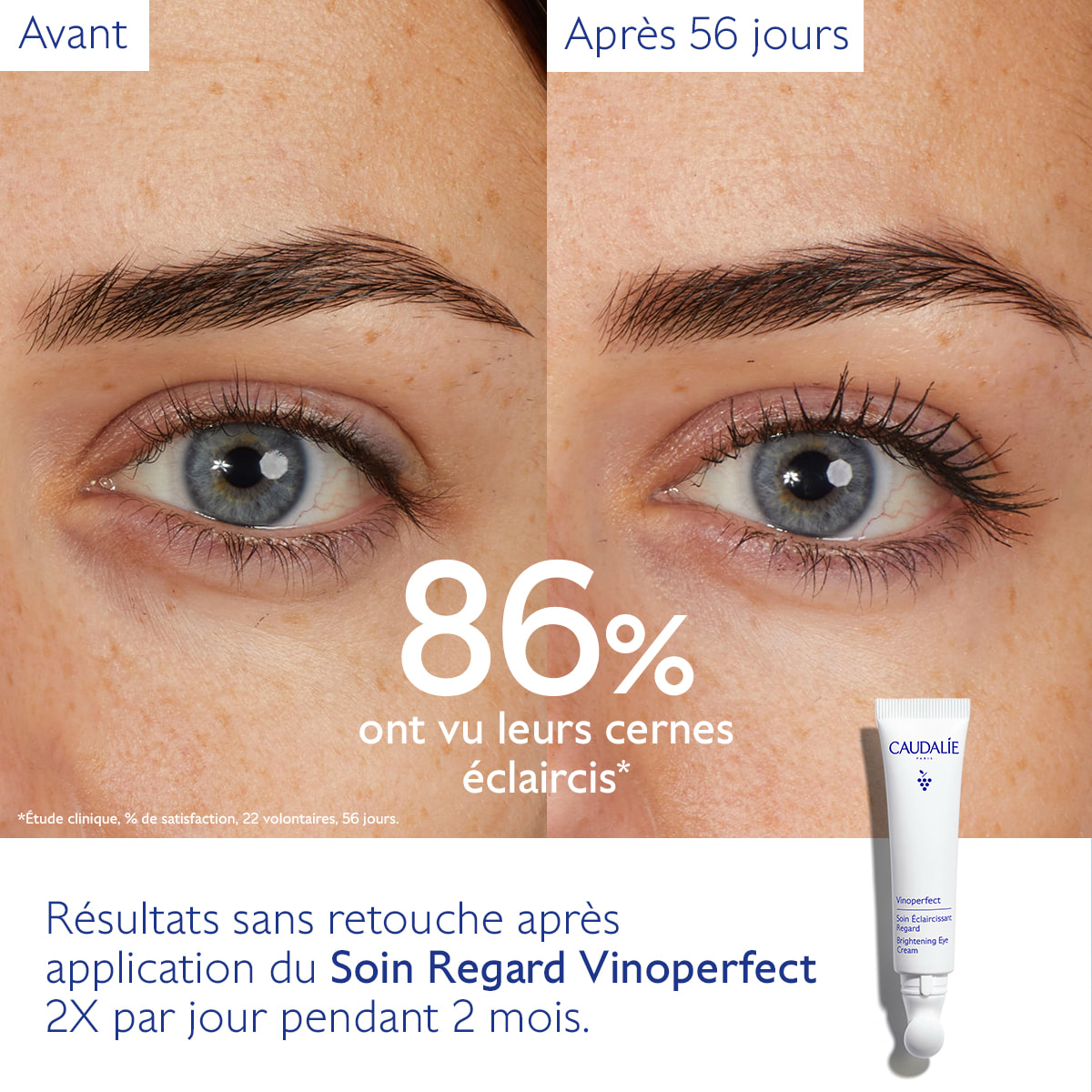 Soin Éclaircissant Regard