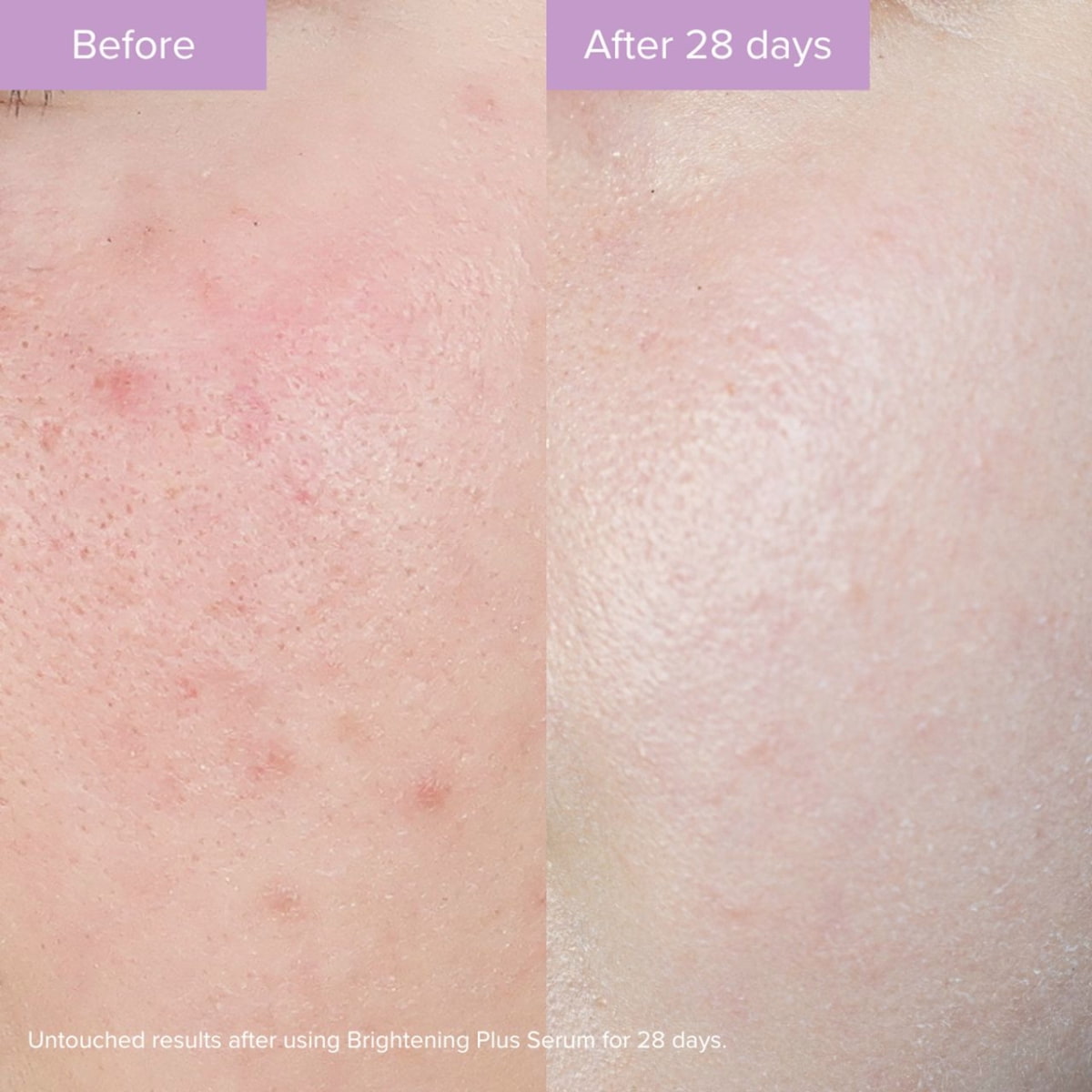 Brightening Plus Serum