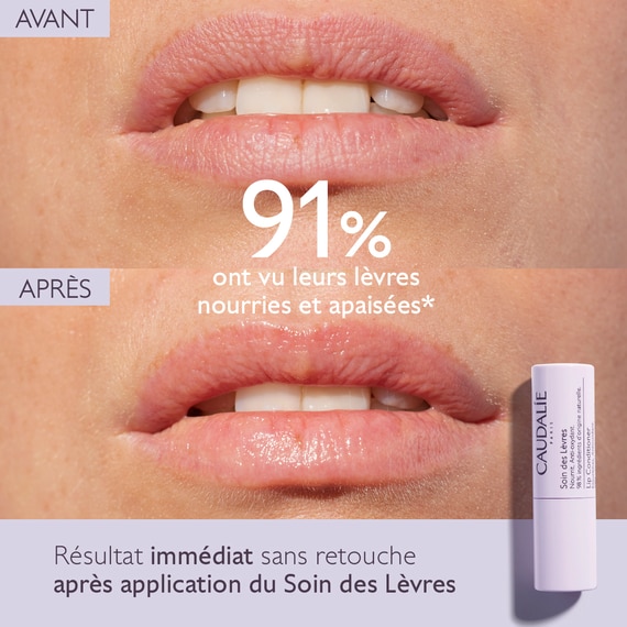 Soin des Lèvres