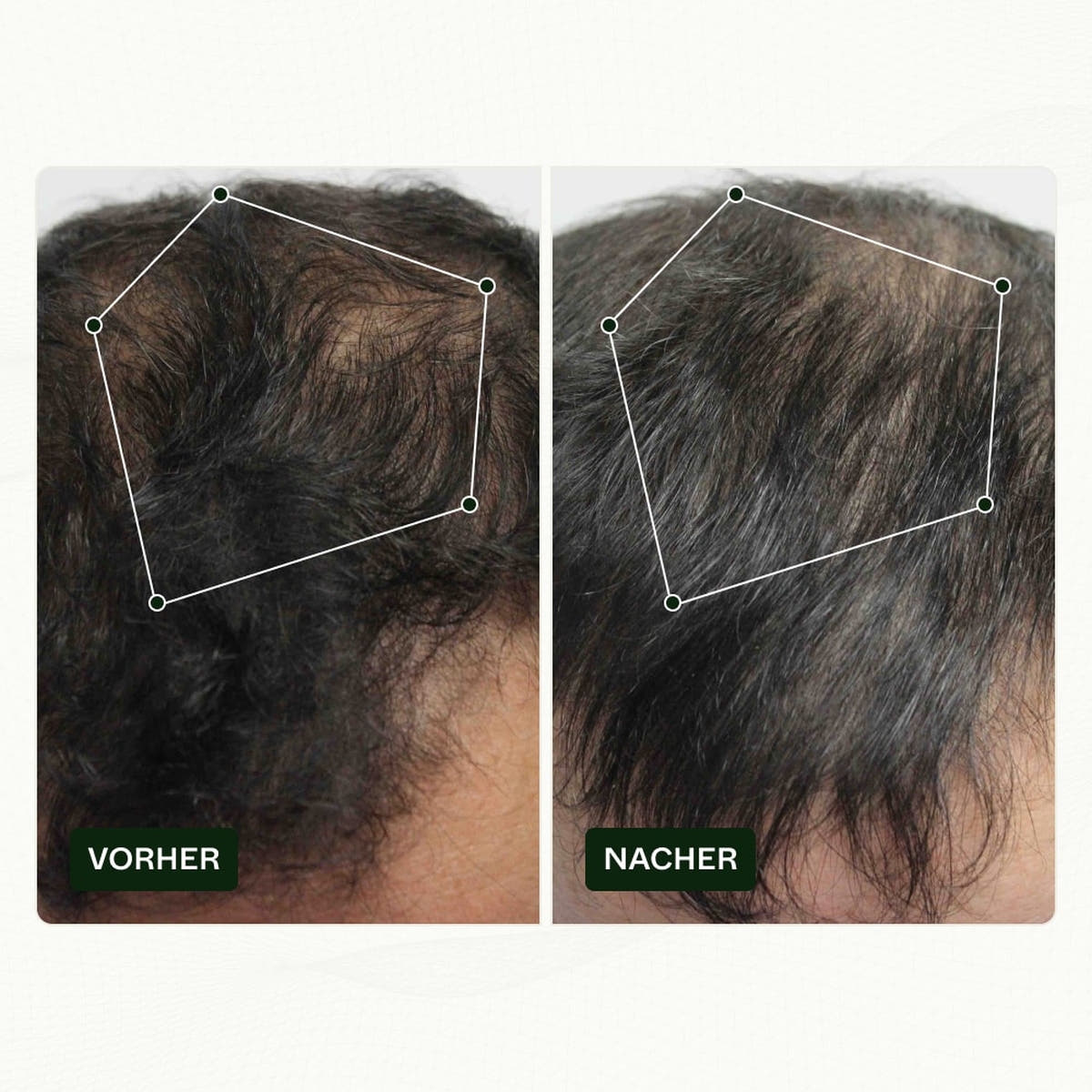 Bio Plixin Serum+ Men