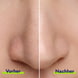 Porenverfeinernde Bubble Nasenmaske