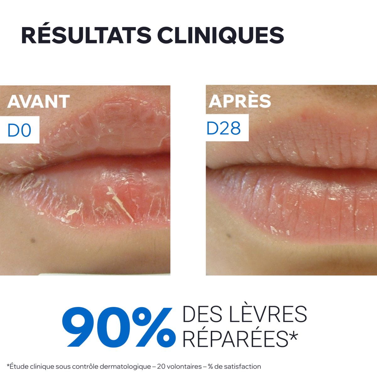 Baume Lèvres