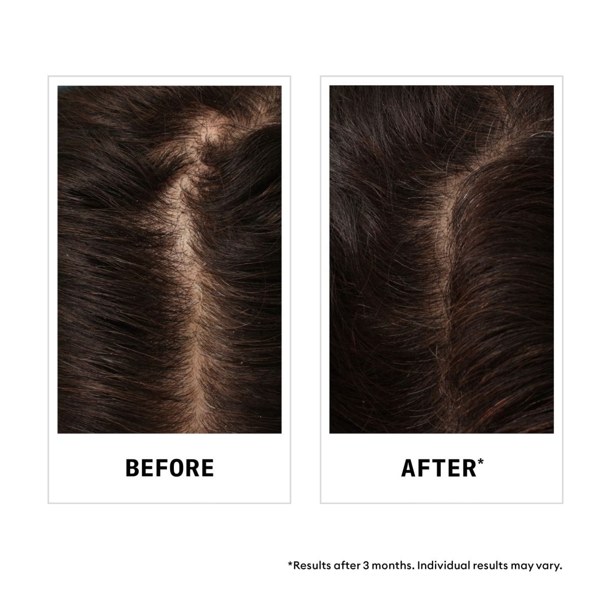 Hair Fall Defense Shampoo