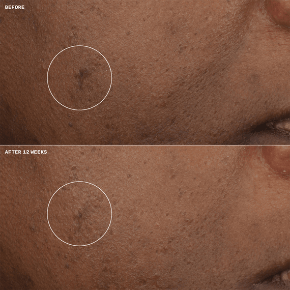 Even Better Clinical - Brightening Moisturizer