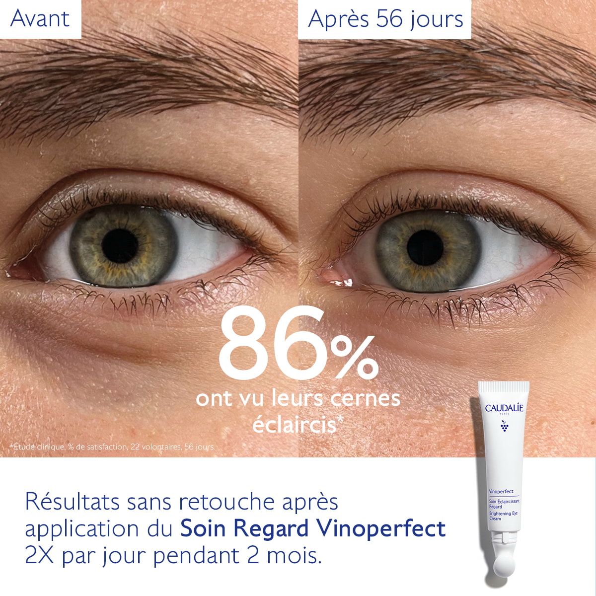 Soin Éclaircissant Regard