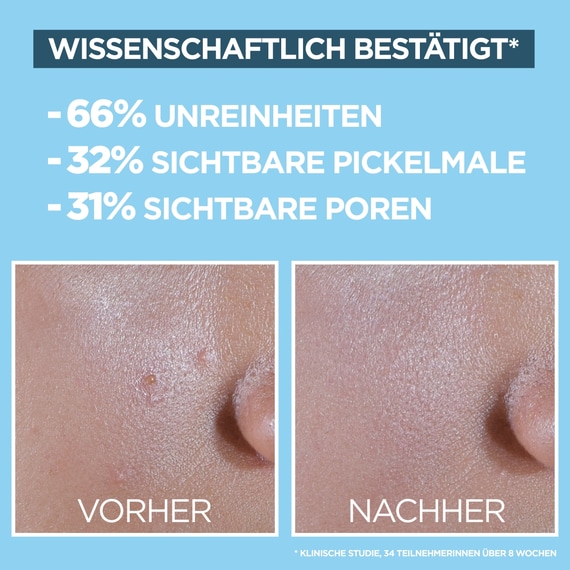 BHA + Niacinamide Daily-UV Anti-Imperfections Fluid Invisible + Matt SPF 50+