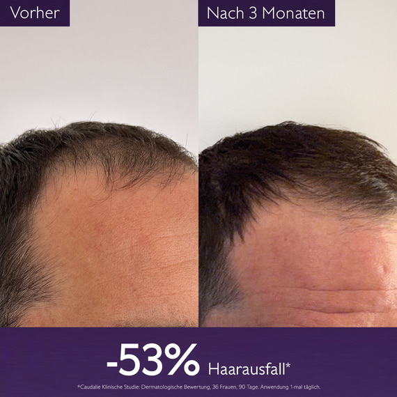Anti-Haarausfall Serum