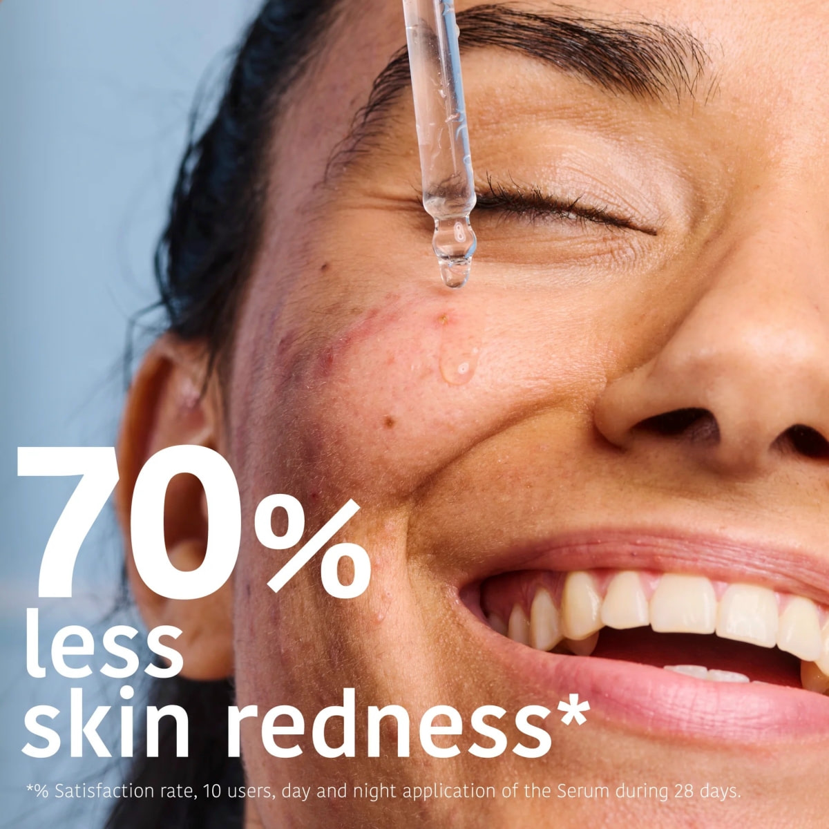Prevent & Correct Anti-Blemish Face Serum with Salicylic Acid