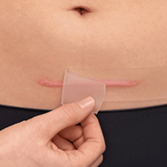 Scar Reduction XL