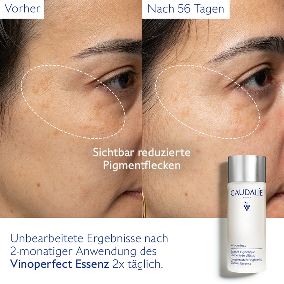 Essenz mit Glykolsäure für mehr Ausstrahlung