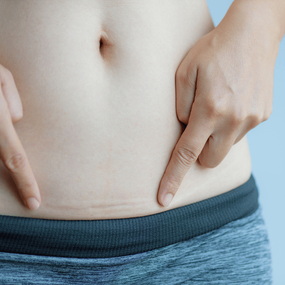 Scar Reduction XL
