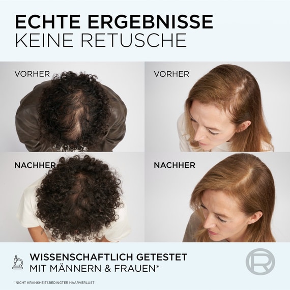 Fiber Booster Anti-Hair Loss Conditioner