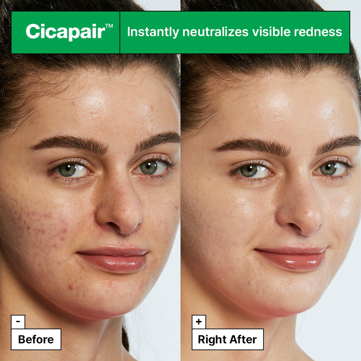 Cicapair Tiger Grass Color Correcting Treatment