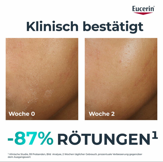 Clinical Therapiebegleitende Feuchtigkeitspflege