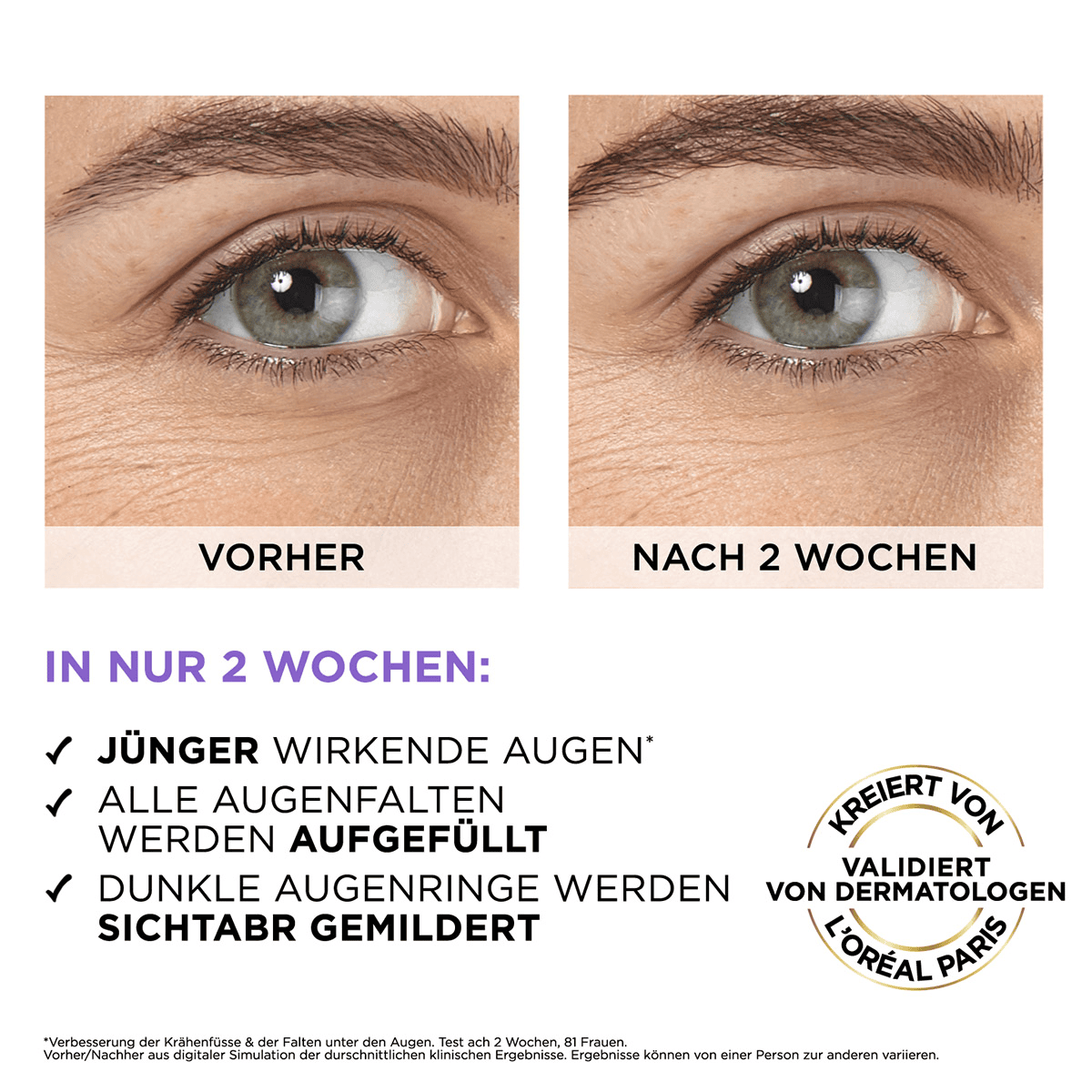 Filler Augenserum