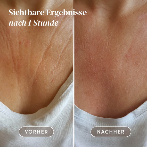 Wiederverwendbare Décolleté Pads mit Vitamin C