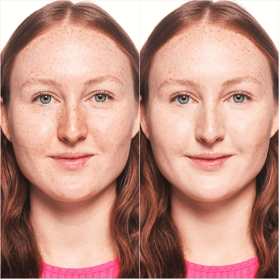 Skin Lovin' Sensitive Concealer
