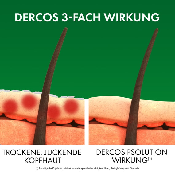 Beruhigendes Pflegeshampoo gegen trockene juckende Kopfhaut