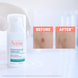 Concentrato intensivo Comedomed+ per imperfezioni e acne