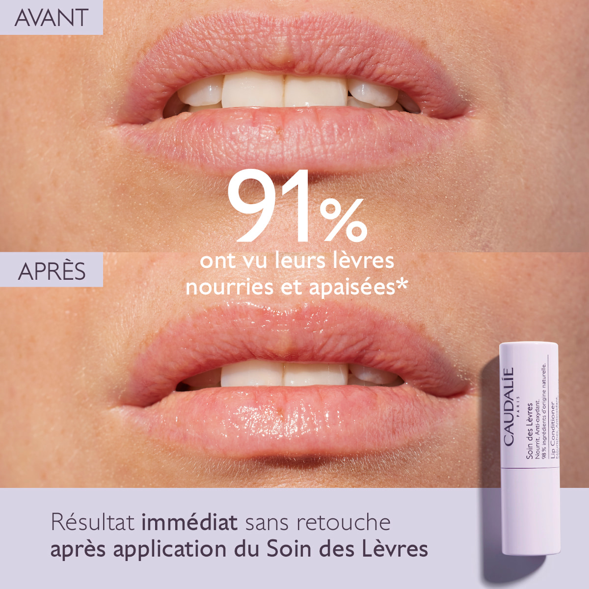 Soin des Lèvres