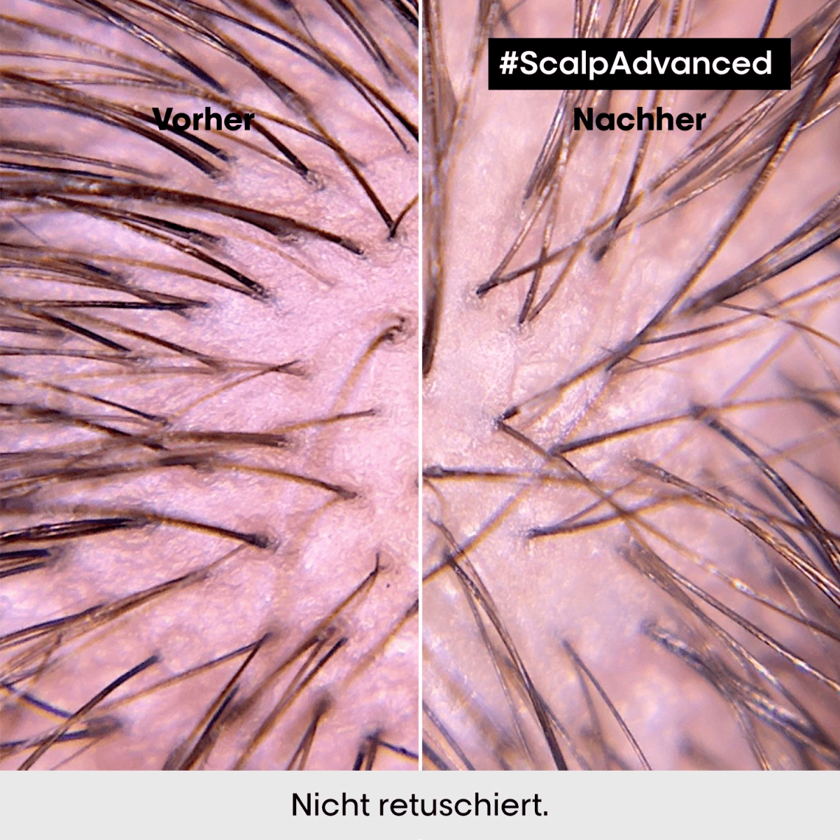 Scalp Advanced Anti-Discomfort Intese Soother Treatment