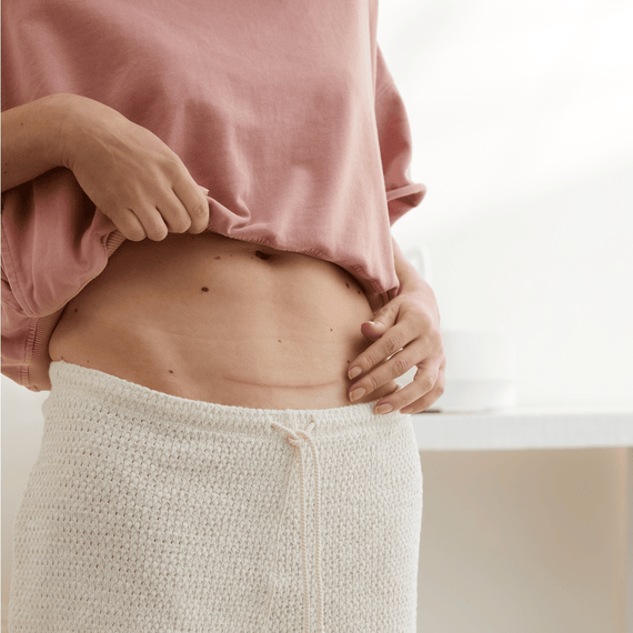 Scar Reduction XL
