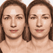True Skin High Cover Concealer