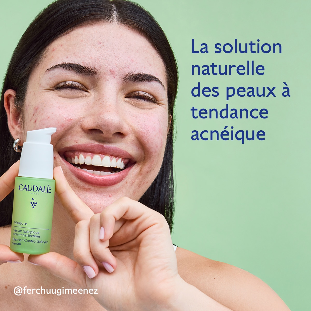 Sérum Anti-Imperfections