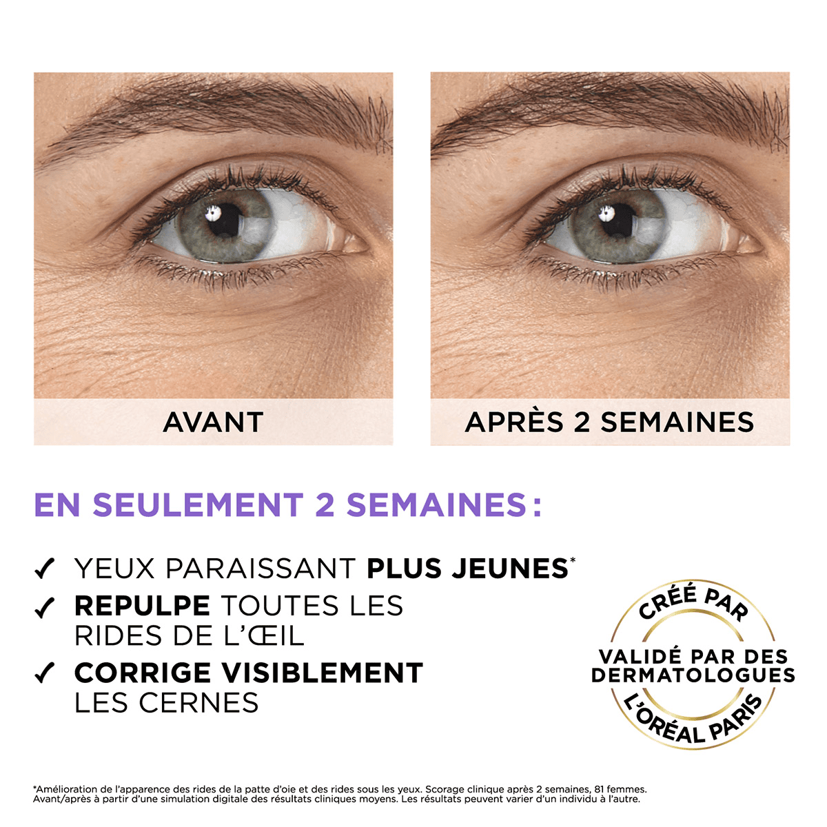 Filler Sérum Yeux